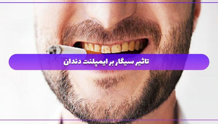 تاثیر سیگار بر ایمپلنت دندان