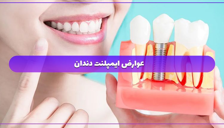 عوارض ایمپلنت دندان