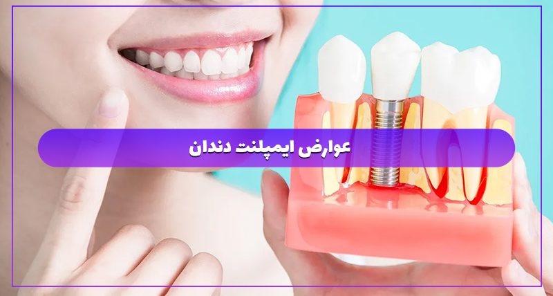 عوارض ایمپلنت دندان