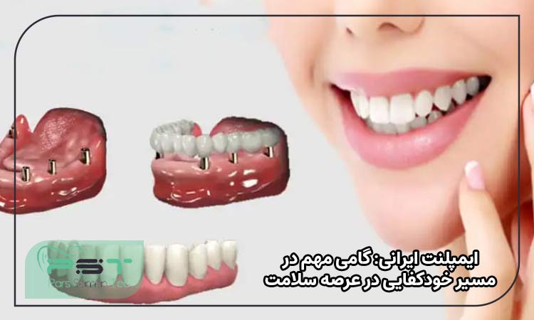 ایمپلنت ایرانی: گامی مهم در مسیر خودکفایی در عرصه سلامت