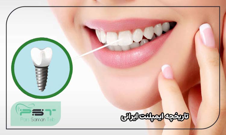 تاریخچه ایمپلنت ایرانی