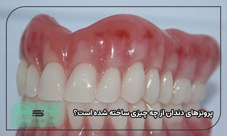 انواع پروتز دندان 
