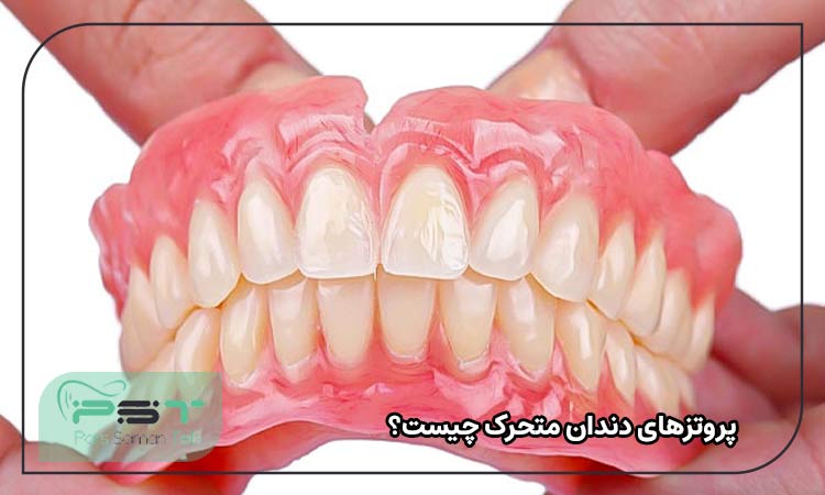 پروتزهای دندان متحرک چیست؟ 