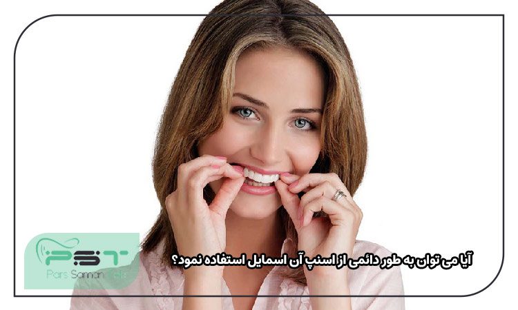 آیا می توان به طور دائمی از اسنپ آن اسمایل استفاده نمود؟