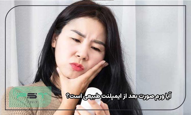 آیا ورم صورت بعد از ایمپلنت طبیعی است؟