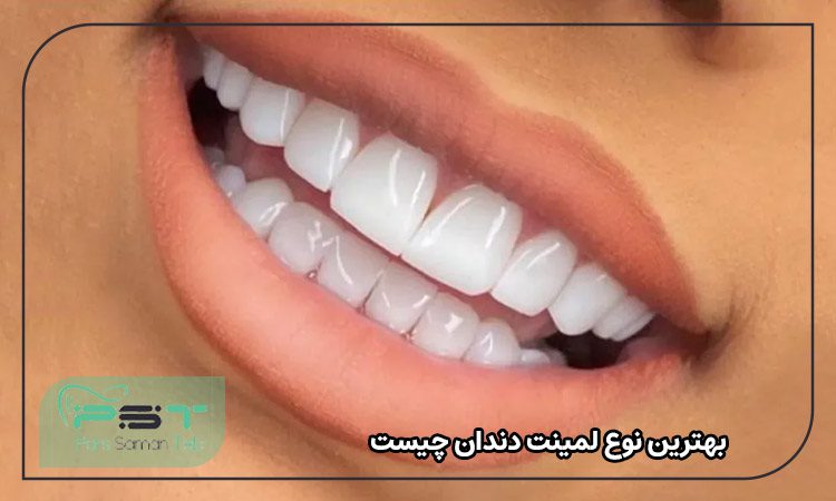 بهترین نوع لمینت دندان کدام است؟