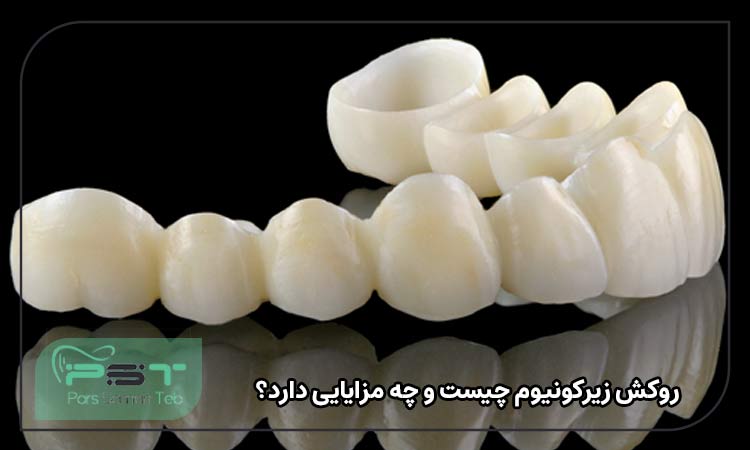 روکش زیرکونیوم چیست و چه مزایایی دارد؟