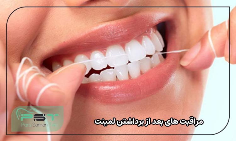 مراقبت ‌های بعد از برداشتن لمینت