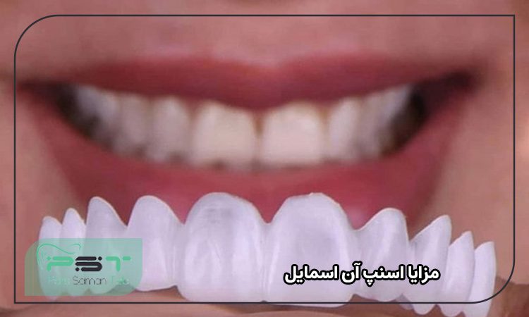 مزایا اسنپ آن اسمایل