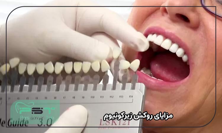 مزایای روکش زیرکونیوم