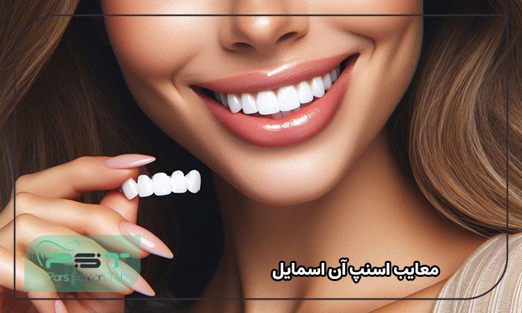 معایب اسنپ آن اسمایل