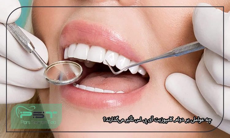 چه عواملی بر دوام کامپوزیت آی پی اس تأثیر میگذارند؟