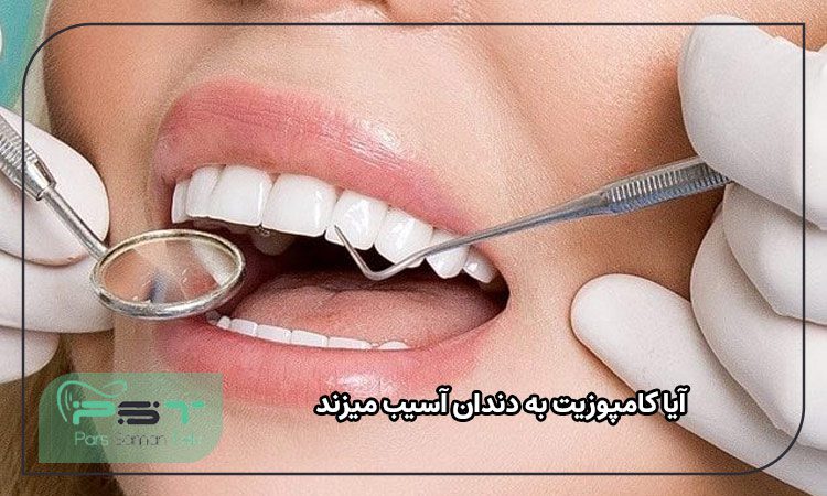 آیا کامپوزیت به دندان آسیب میزند