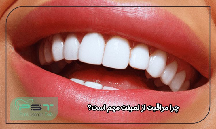 چرا مراقبت از لمینت مهم است؟