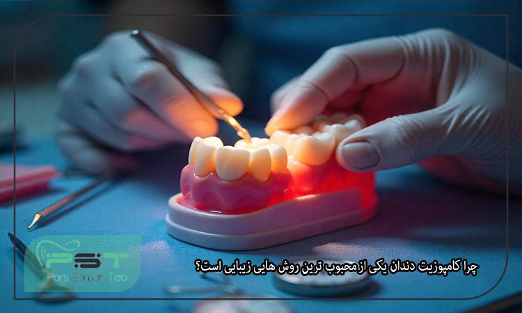 کامپوزیت باعث پوسیدگی دندان میشود.