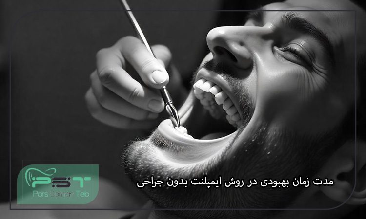 ایمپلنت بدون جراحی