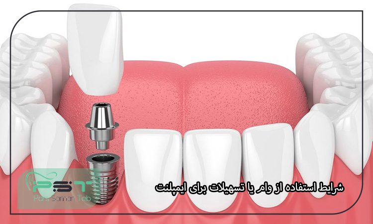 پوشش هزینه ایمپلنت دندان با بیمه