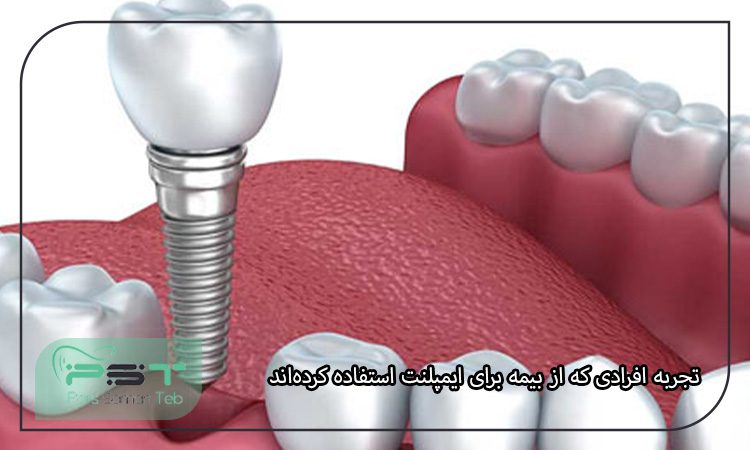 پوشش هزینه ایمپلنت دندان با بیمه