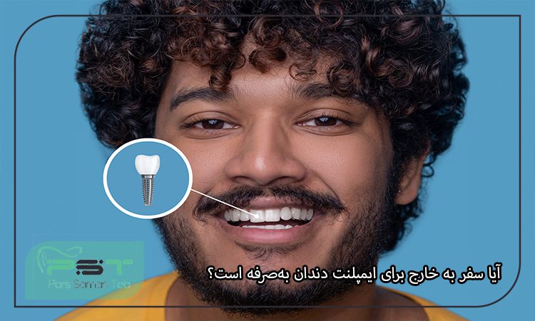 بهترین کشورها برای انجام ایمپلنت دندان