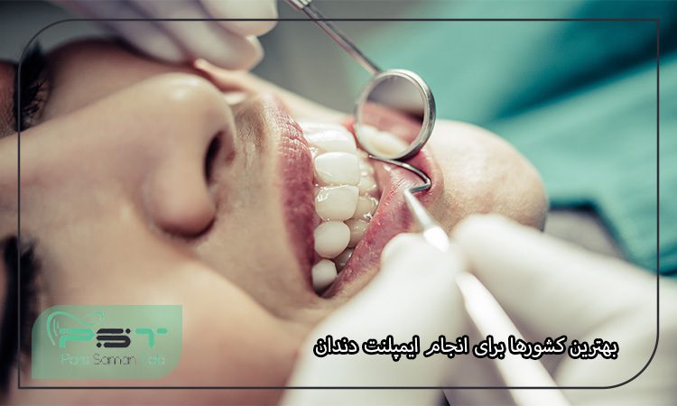 بهترین کشورها برای انجام ایمپلنت دندان