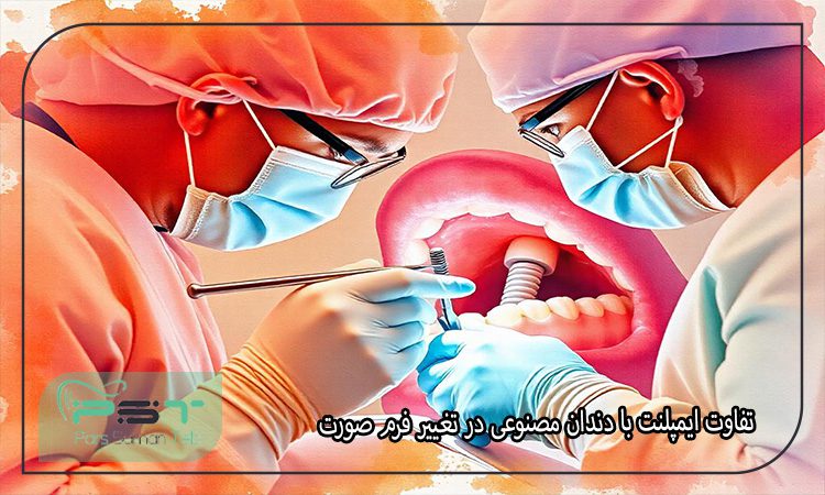 تاثیر ایمپلنت دندان بر چهره