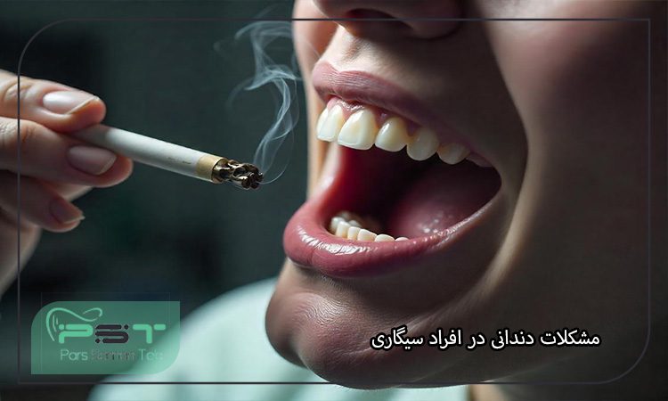بیماریهای دهان و دندان ناشی از سیگار کشیدن