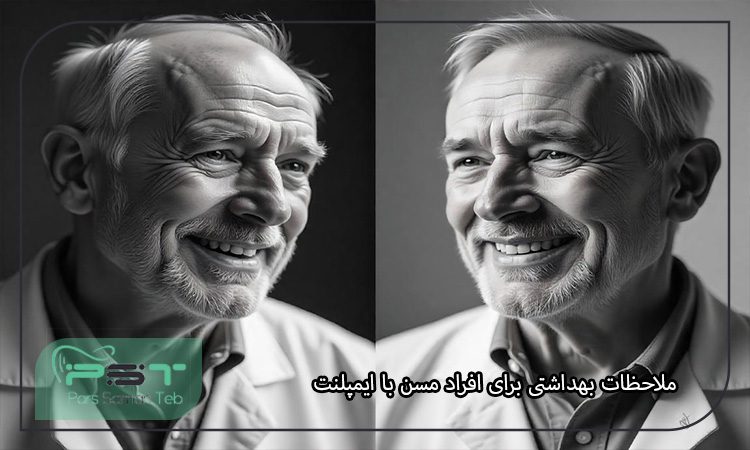 تاثیر سن بر موفقیت کاشت ایمپلنت دندان