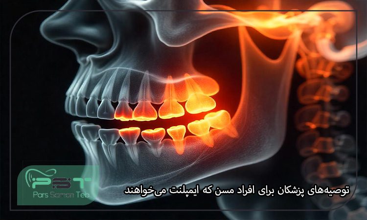 تاثیر سن بر موفقیت کاشت ایمپلنت دندان