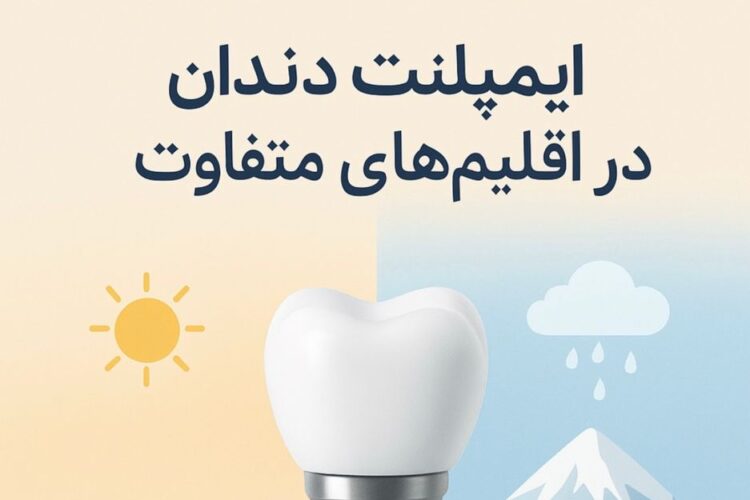 ایمپلنت دندان در اقلیمهای متفاوت: چالشها، راهکارها و نقش ایمپلنت DPI