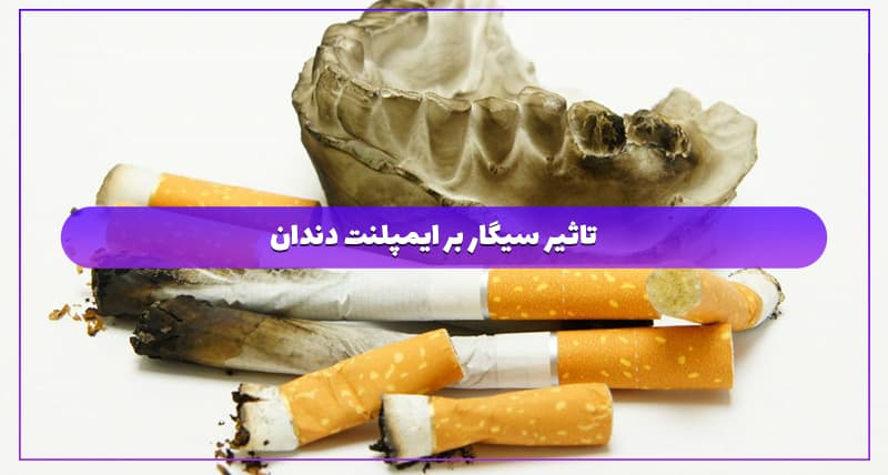 تاثیر سیگار بر ایمپلنت دندان 1