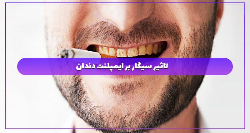 تاثیر سیگار بر ایمپلنت دندان