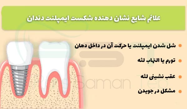 علائم شایع نشان دهنده شکست ایمپلنت دندان