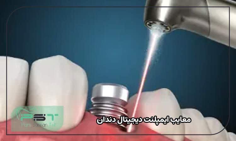 معایب ایمپلنت دیجیتال دندان