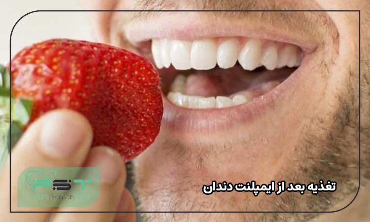 تغذیه بعد از ایمپلنت دندان