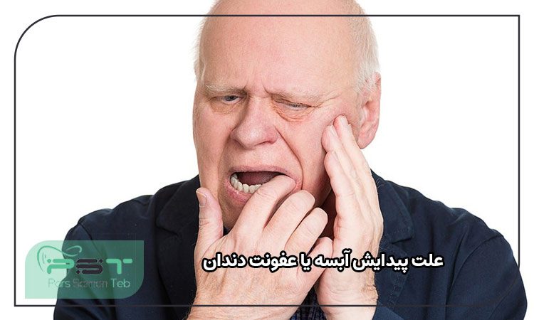 علت پیدایش آبسه یا عفونت دندان