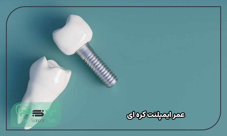 عمر ایمپلنت کره‌ای