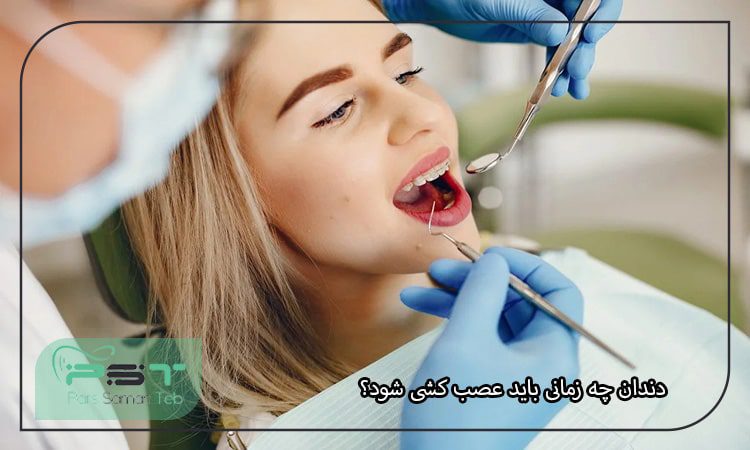 دندان چه زمانی باید عصب کشی شود؟