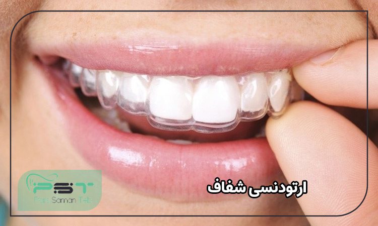 ارتودنسی نامرئی با پلاک‌های شفاف