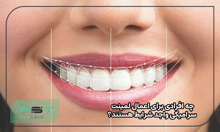 چه افرادی برای اعمال لمینت سرامیکی واجد شرایط هستند؟