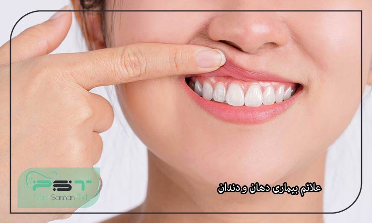 خطرناک ترین بیماری های دهان و دندان