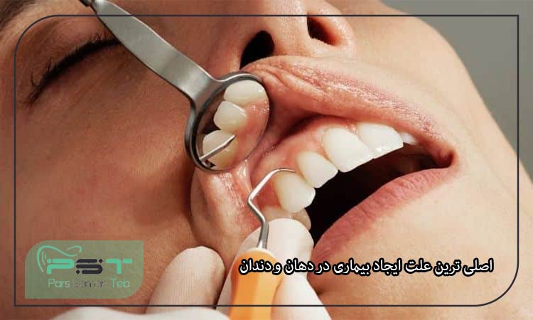 خطرناک ترین بیماری های دهان و دندان