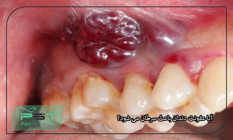 خطرناک ترین بیماری های دهان و دندان