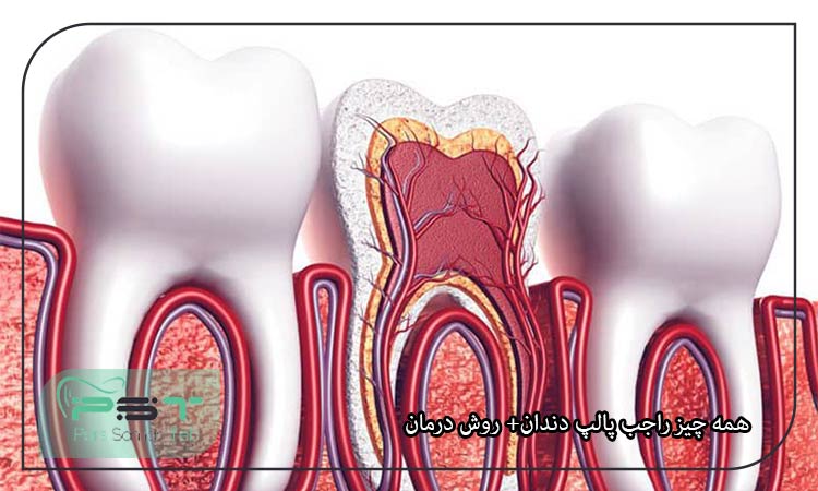 همه چیز راجب پالپ دندان+ روش درمان