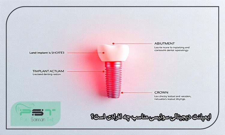 ایمپلنت دندان دیجیتالی