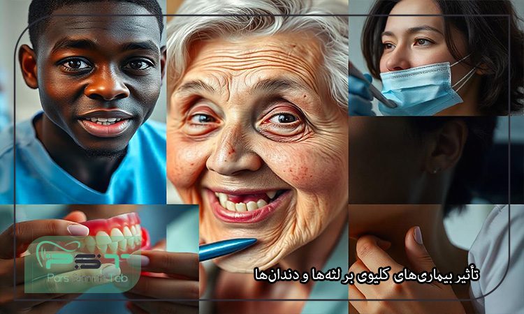 بیماری‌های سیستمیک و سلامت دهان