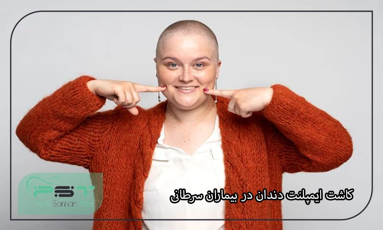 کاشت ایمپلنت دندان در بیماران سرطانی