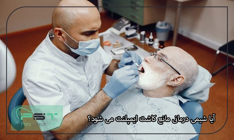 آیا شیمی ‌درمانی مانع کاشت ایمپلنت می‌ شود؟