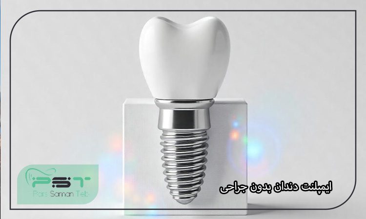 ایمپلنت بدون جراحی