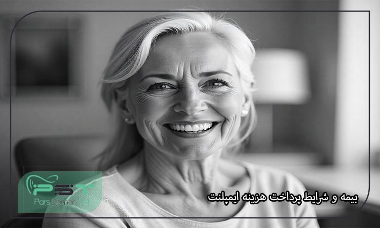 هزینه ایمپلنت دندان در ایران و سایر کشورها