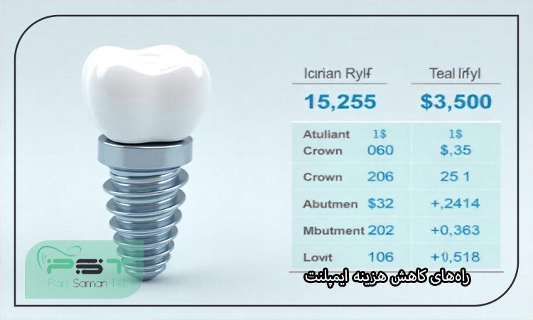 هزینه ایمپلنت دندان در ایران و سایر کشورها